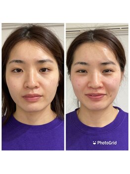 ブランソワン/定期的に通ってくださってます！