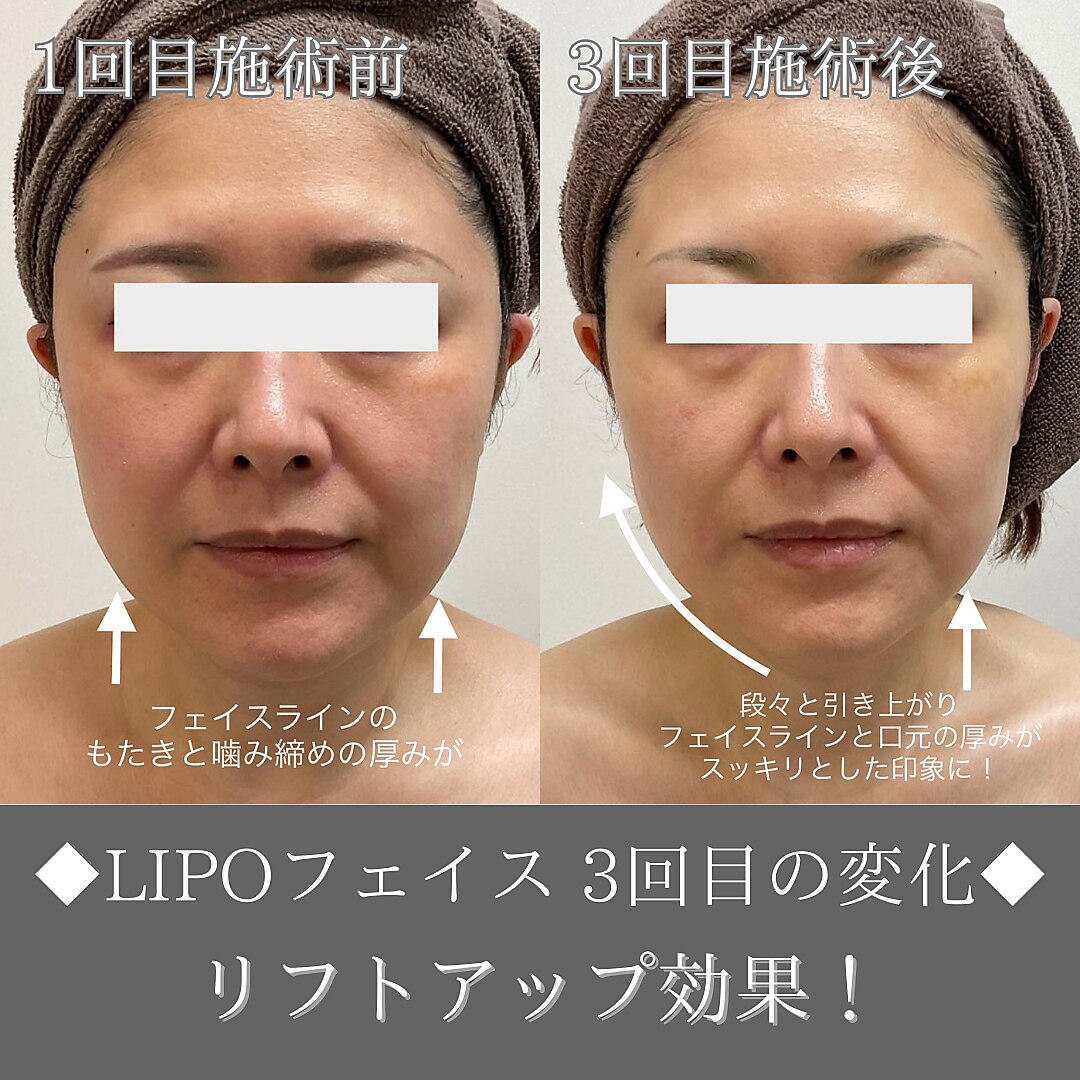 ナンバーファイブクリニカルサロン 札幌店(No.5)｜ホットペッパー