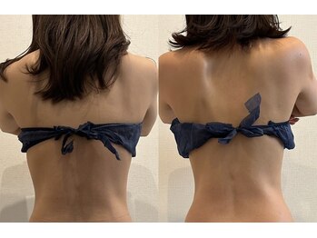 シェリア(Sherien)/肩甲骨筋リンパマッサージ