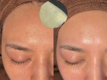 ルーナジェーナ(Luna llena)/池袋　エステ　ルーナジェーナ