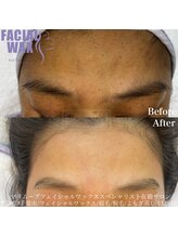 エリス(ELISSE)/くすみのお悩みが解消