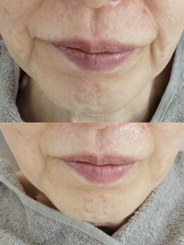 ビーユー(Be.you)/しわたるみが気になる方へ・・・