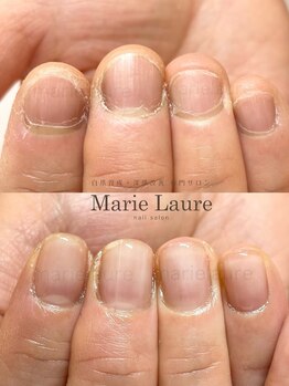 マリーロール 天王寺店(Marie Laure)/深爪矯正/自爪育成/ネイルケア