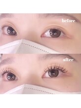 ウララ(uraura)/befor after