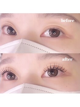 ウララ(uraura)/befor after