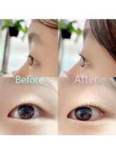 ミヌエット(MINUET)/Before→After