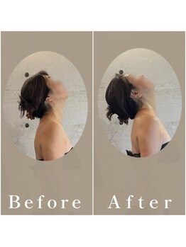 デュッカ 箕面(Ducca)/トリムヘッド