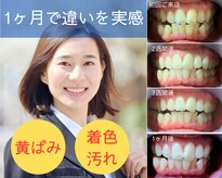 ネージュ(neige)