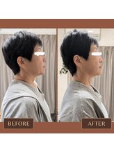 ヨサパーク チェリー(YOSA PARK CHERRY)/