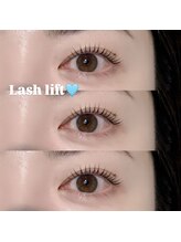 リンネ(LinNe)/KURUMI担当