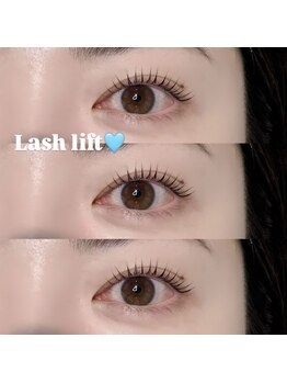 リンネ(LinNe)/KURUMI担当