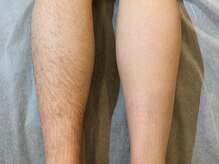 ユーフォリアファステ シルキーメンズ(Euphoria Faste Silky Men's)