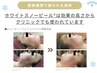 《剥離/皮向けしないピーリング》ホワイトスノーピール［美白/シミ］¥18700→