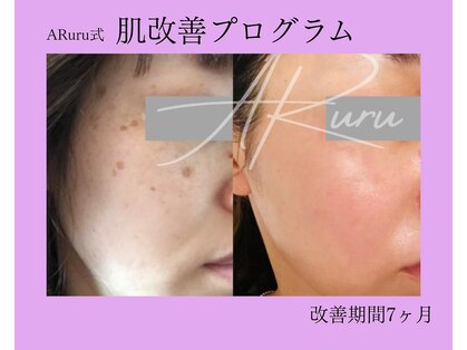 アルルプラス 南草津(ARuru+)の写真