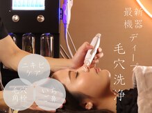 カームアライン(CALM ALIGN)