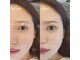アイラッシュ ティル(eyelash till)の写真