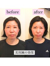 ゲンキ鍼灸整骨院 かどの(Genki鍼灸整骨院)/美容鍼