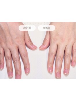ハンドケアが得意なサロン
