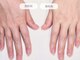 オトナネイル(otona nail)の写真/選べる2種の集中コース＊手にも丁寧なお手入れを。トーン差/痩せ感/ハリ不足などお悩み集中ケアをご用意