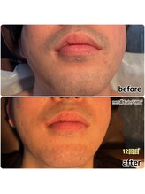 シンバ 倉敷店(SIMBA)/