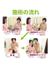 プランドール/施術の流れです