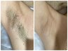 【ワキ脱毛】一度で効果実感・都度OK。何度でも嬉しいこの価格→《1200》