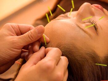 矢部駅前 ひばり鍼灸整骨院 整体院/美容鍼も人気です