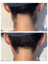 ピュア 川越店/うなじ脱毛