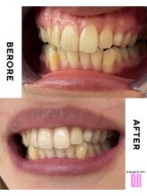 エクシアホワイトニング 王寺店/