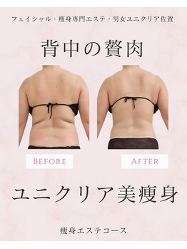 ユニクリア(Uni clear)/佐賀市│人気の痩身エステ