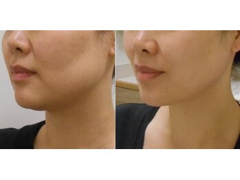 ビューティークリニーク アマーレ(Amare)/