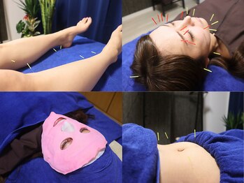 鍼灸整体院アレンジの写真/日本美容鍼灸マッサージ協会認定院で鍼灸・整体を組合わせて身体の不調&肌トラブルを根本改善！[名古屋]