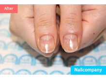 ネイルカンパニー/