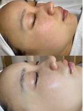 ユミサロン(U Mi Salon)/フェイスパウダーいらない透明感