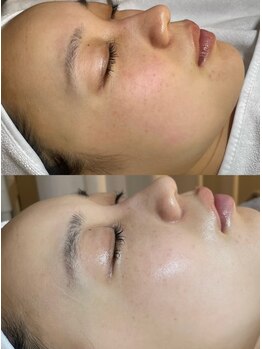 ユミサロン(U Mi Salon)/フェイスパウダーいらない透明感