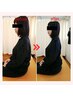 【姿勢・骨盤矯正】猫背/O脚/ストレートネック/肩こり/腰痛/頭痛等の改善に