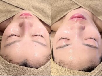 マノマノ エミュー(manomano emu)の写真/迷った方はまずはこちら！北千住希少☆【艶玉小顔フェイシャル】なにがなんでも肌悩みを解消したい方へ