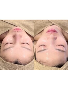 ハリツヤをUPしたい