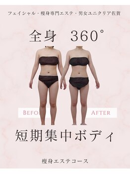 ユニクリア(Uni clear)/佐賀市ユニクリア・痩身エステ