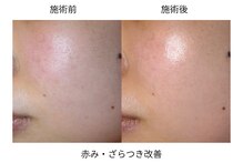 ソワンドボーテ クー(Soin de Beaut'e Quu)