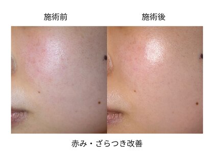 ソワンドボーテ クー(Soin de Beaut'e Quu)の写真