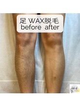 ビビユー(bibi u)/足《WAX脱毛》beforeafter/池袋