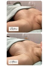 B.B藤沢 レオスタイル(LeoStyle)/バストだけに脂肪をつける方法