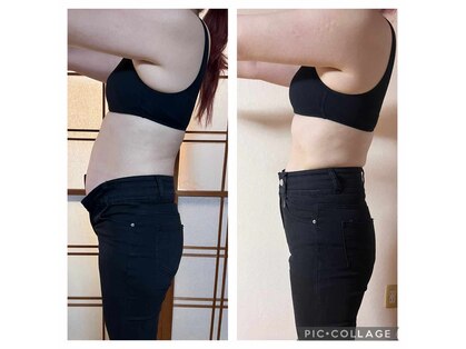 ヨサパークカーラ 宮崎駅(YOSA PARK CARA)の写真