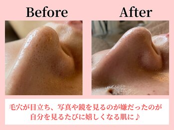 ココロ(COCORO)/美脳小顔矯正&毛穴洗浄