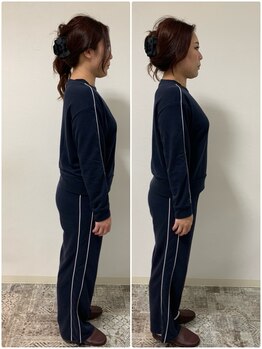 ア ニュームーン 京都烏丸店(a New Moon)/姿勢　骨格矯正ビフォーアフター