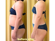 エイチラボ(H lab.)の雰囲気(温熱セラピ×キャビで熱を練り込んで排出。健康的に痩せましょう)