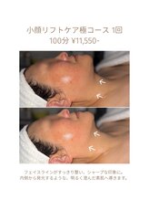 ハピスリー(Hapisley)/掲載許可、頂いております。