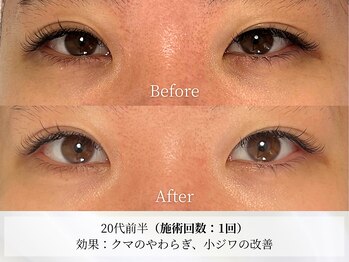 アストリエ グレース 相模大野(Astorie Grace)/目元エステ1回でも効果◎