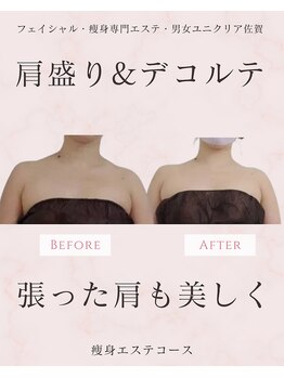 ユニクリア(Uni clear)/佐賀市│人気の痩身エステ